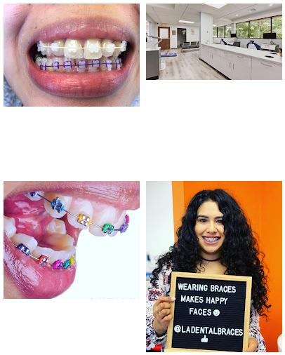 L.A. Dental Braces