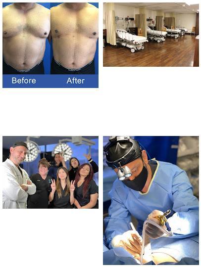 Gynecomastia Surgery Center of Los Angeles