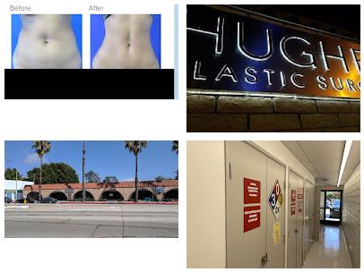 Dr. Kenneth Hughes MD, Plastic Surgeon in Los Angeles and Beverly Hills