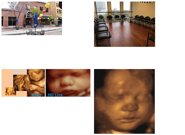 Treasured Moments 4D Ultrasounds Los Angeles