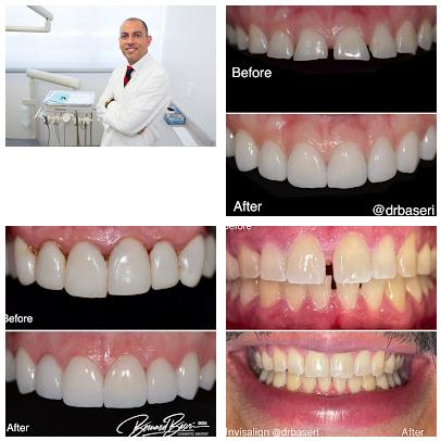 Smile Recreation Dentistry, Porcelain Veneers, Invisalign, Root Canals, periodontics, Oral Surgery, and Emergency Dentistry