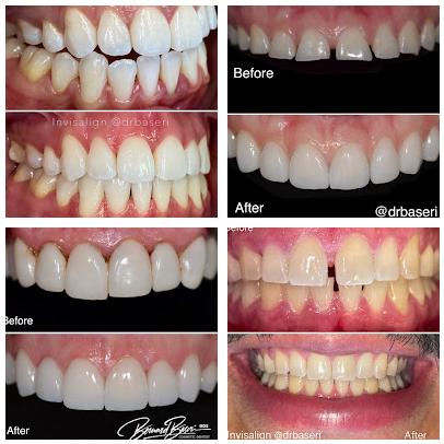 Smile Recreation Dentistry, Porcelain Veneers, Invisalign, Root Canals, periodontics, Oral Surgery, and Emergency Dentistry