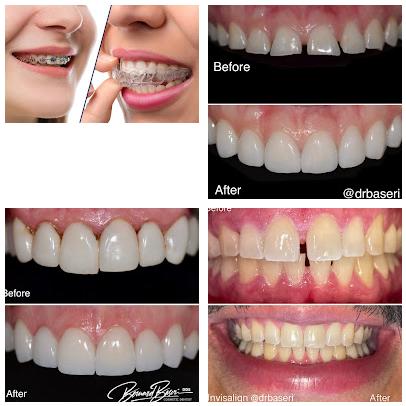 Smile Recreation Dentistry, Porcelain Veneers, Invisalign, Root Canals, periodontics, Oral Surgery, and Emergency Dentistry