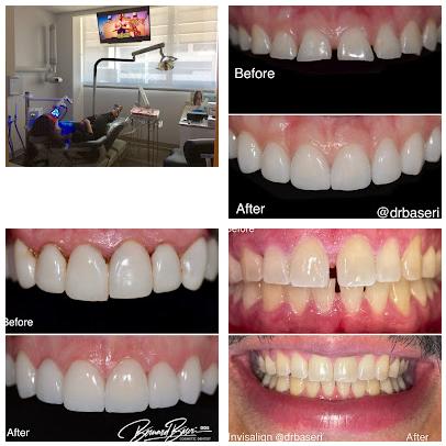 Smile Recreation Dentistry, Porcelain Veneers, Invisalign, Root Canals, periodontics, Oral Surgery, and Emergency Dentistry