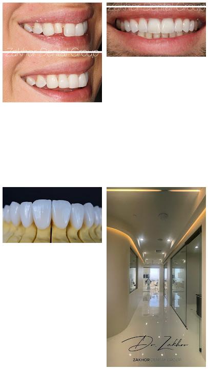 Zakhor Dental Group-Los Angeles Cosmetic Dentist- porcelain Veneers, Invisalign, 24 hour Emergency Dental Services-