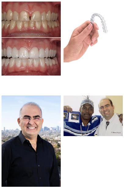 Dental Veneers Specialist On Wilshire