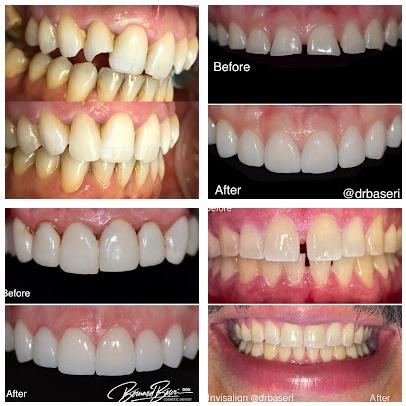 Smile Recreation Dentistry, Porcelain Veneers, Invisalign, Root Canals, periodontics, Oral Surgery, and Emergency Dentistry